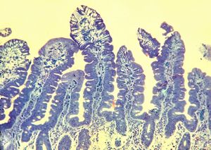 arteficially injured top of microvilli by the endoscope … semithin section